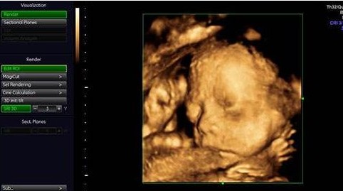 粉袜是女蓝袜是男？这家摄影店竟用这种方式暗